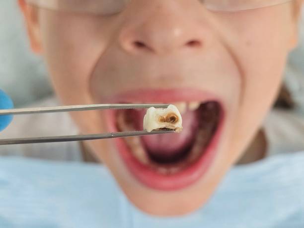 Best Emergency Care for Gum Disease in Fridley, MN